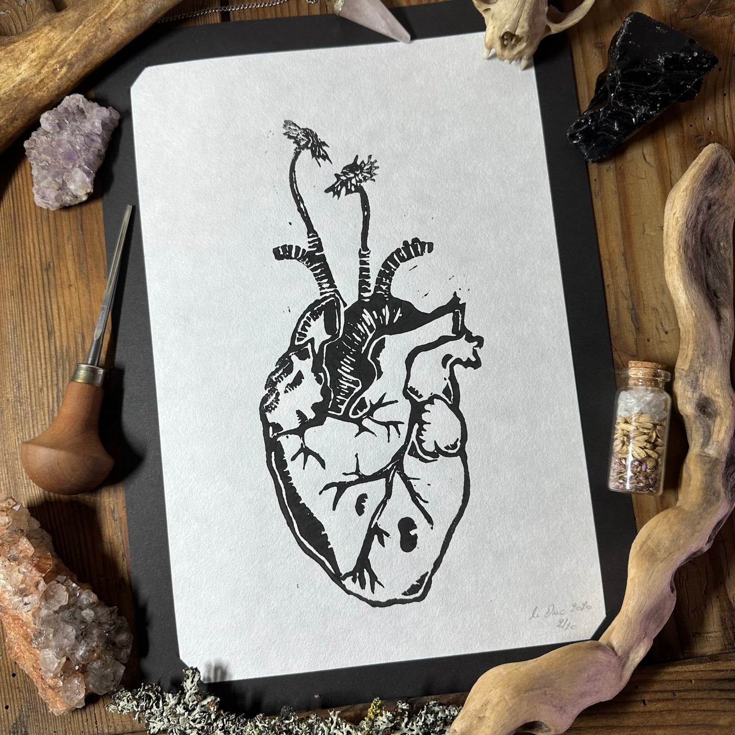 Anatomical heart